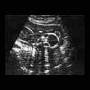 Baby Scan Image